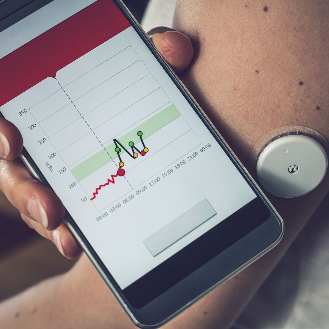 Trend Analysis and Alerts