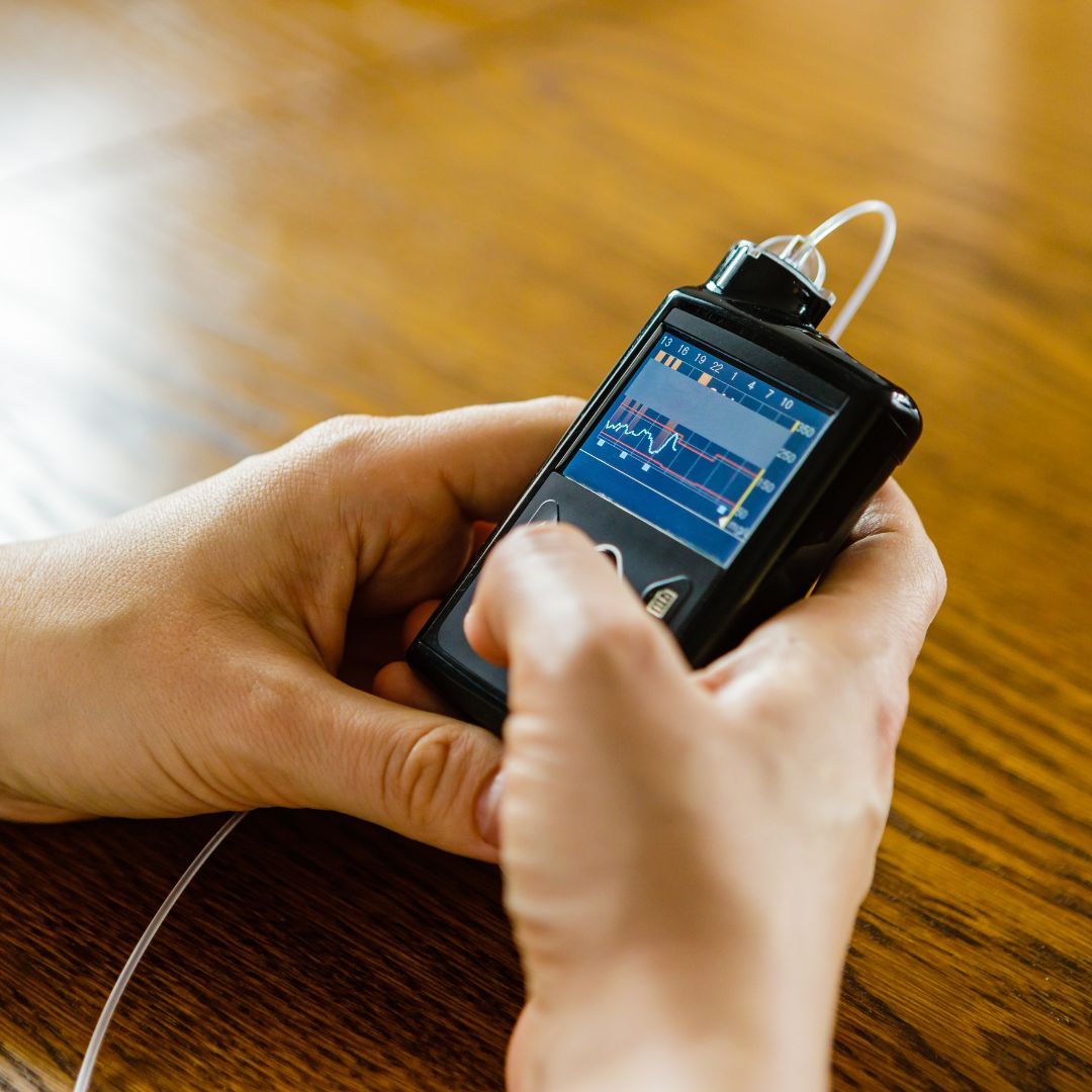 checking insulin pump