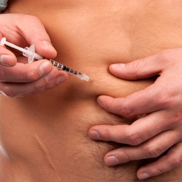 Injecting insulin into an abdomen